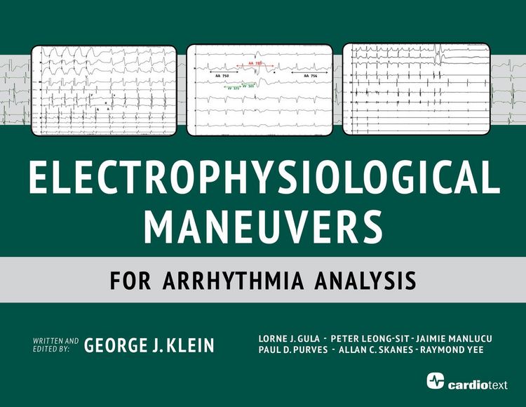 Produktbild: Electrophysiological Maneuvers for Arrhythmia Analysis