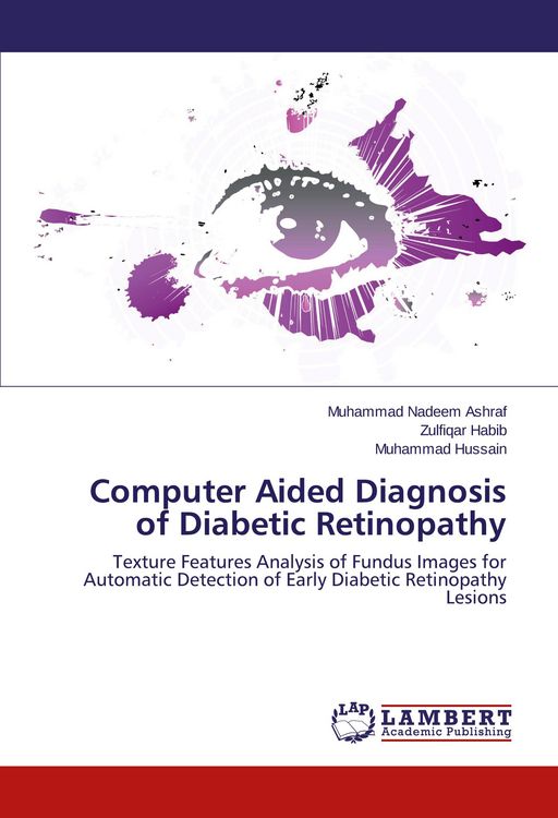 Produktbild: Computer Aided Diagnosis of Diabetic Retinopathy