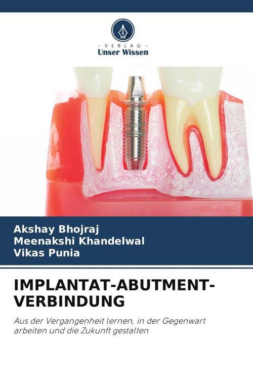 Produktbild: Implantat-Abutment-Verbindung