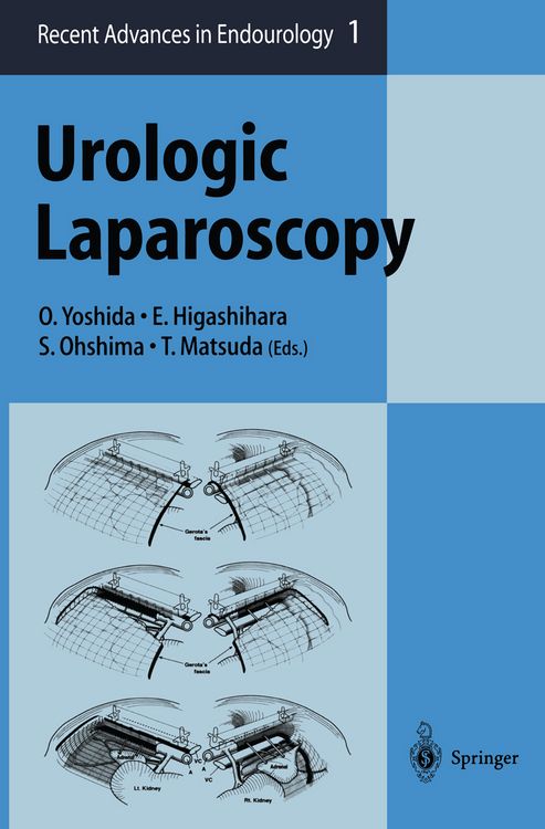 Produktbild: Urologic Laparoscopy