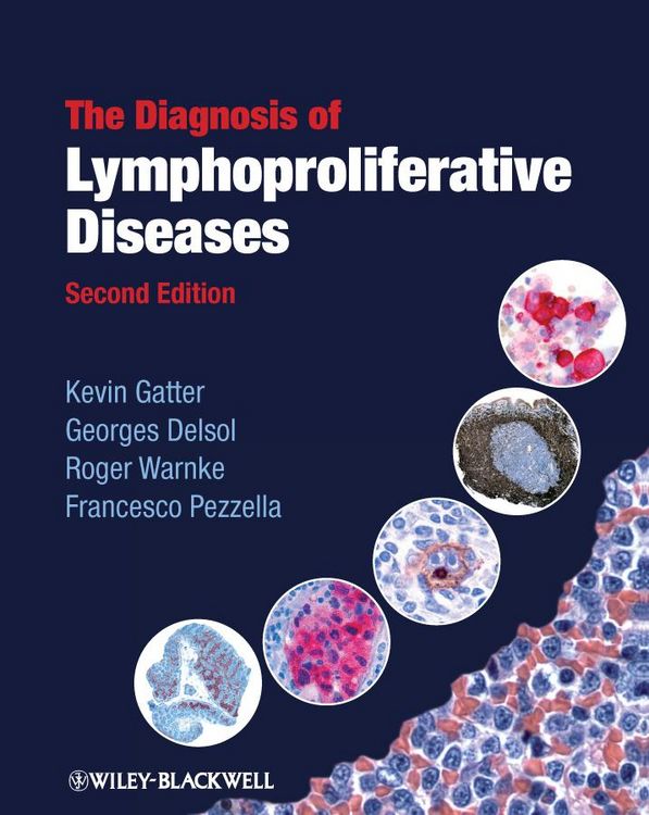 Produktbild: The Diagnosis of Lymphoproliferative Diseases