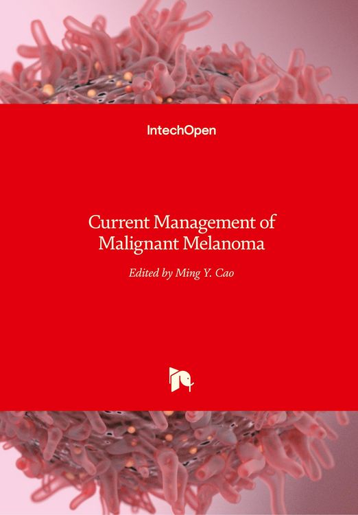 Produktbild: Current Management of Malignant Melanoma