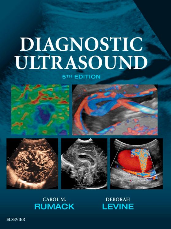 Produktbild: Diagnostic Ultrasound