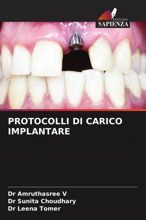 Produktbild: Protocolli Di Carico Implantare