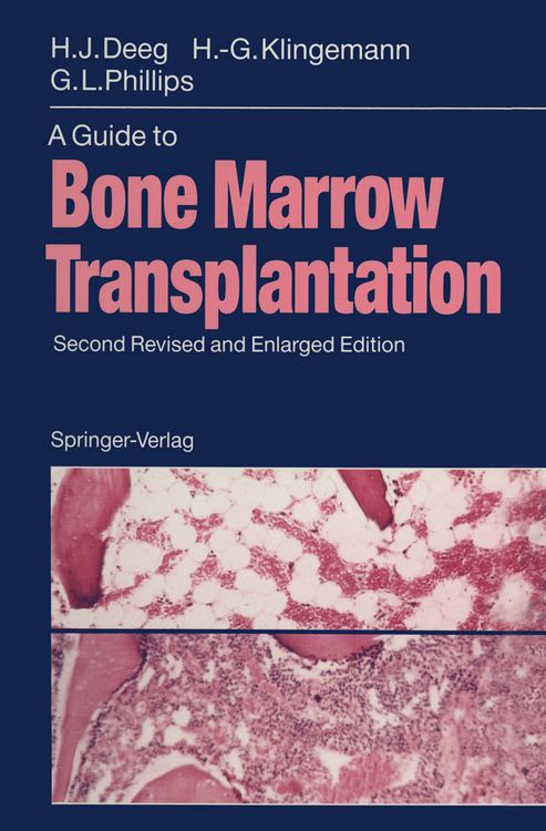 Produktbild: A Guide to Bone Marrow Transplantation