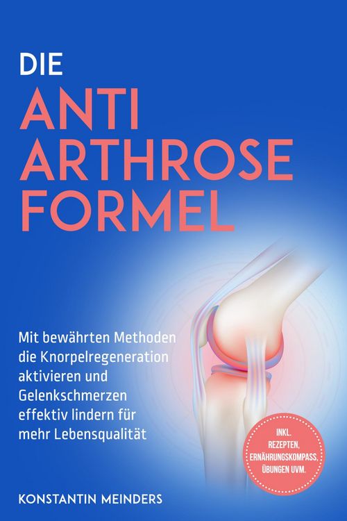 Produktbild: Die Anti Arthrose Formel: Mit bew&auml;hrten Methoden die Knorpelregeneration aktivieren und Gelenkschmerzen effektiv lindern f&uuml;r mehr Lebensqualit&auml;t - ink
