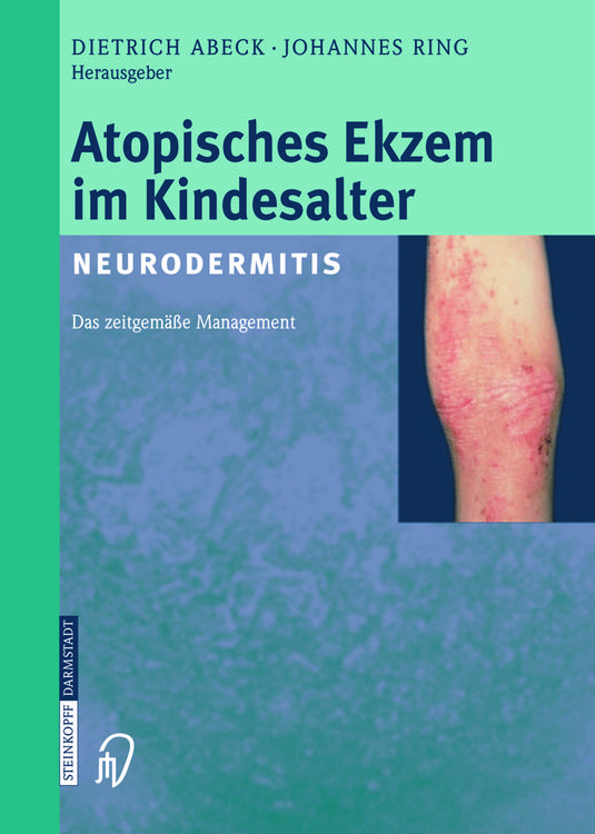 Produktbild: Atopisches Ekzem im Kindesalter (Neurodermitis)