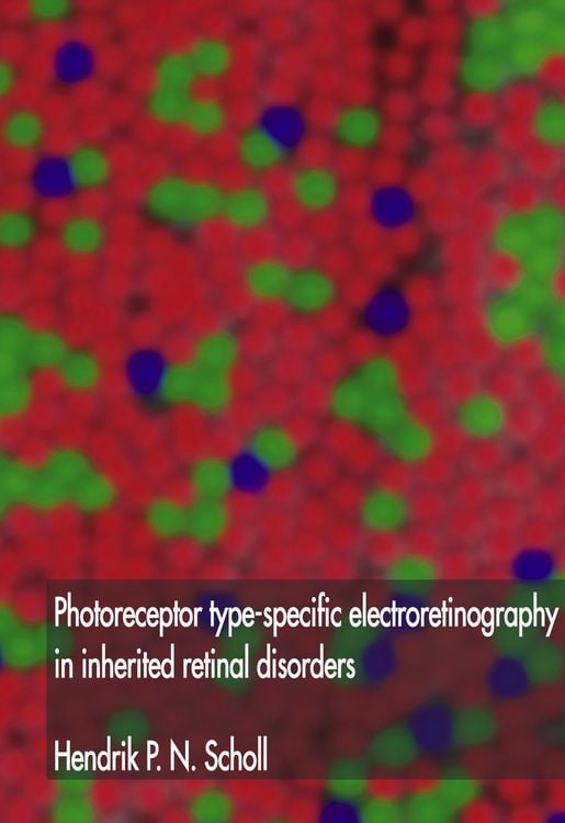 Produktbild: Photoreceptor type-specific electroretinography in inherited retinal disorders