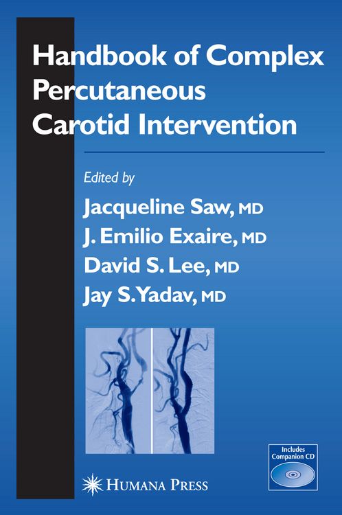 Produktbild: Handbook of Complex Percutaneous Carotid Intervention