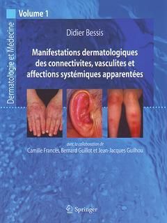 Produktbild: Manifestations dermatologiques des connectivites, vasculites et affections syst&eacute;miques apparent&eacute;es