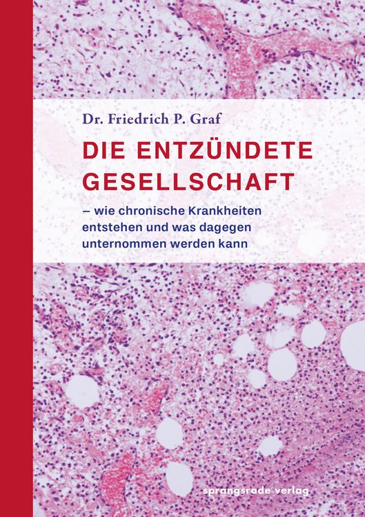 Produktbild: Die entz&uuml;ndete Gesellschaft