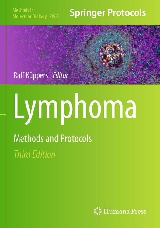 Produktbild: Lymphoma