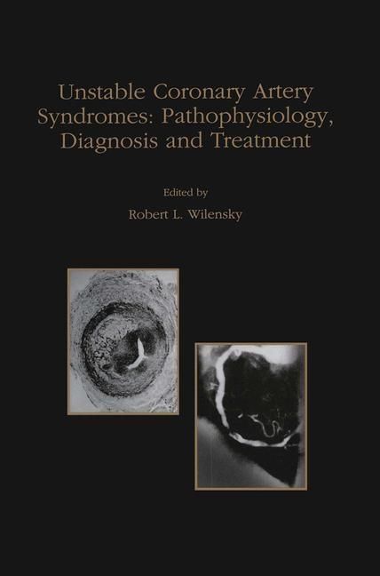Produktbild: Unstable Coronary Artery Syndromes Pathophysiology, Diagnosis and Treatment