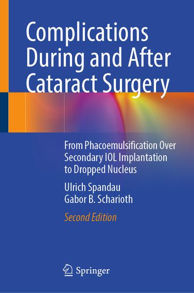 Produktbild: Complications During and After Cataract Surgery