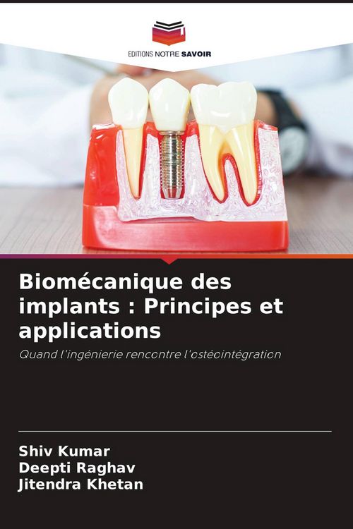 Produktbild: Biom&eacute;canique des implants : Principes et applications