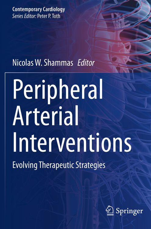 Produktbild: Peripheral Arterial Interventions