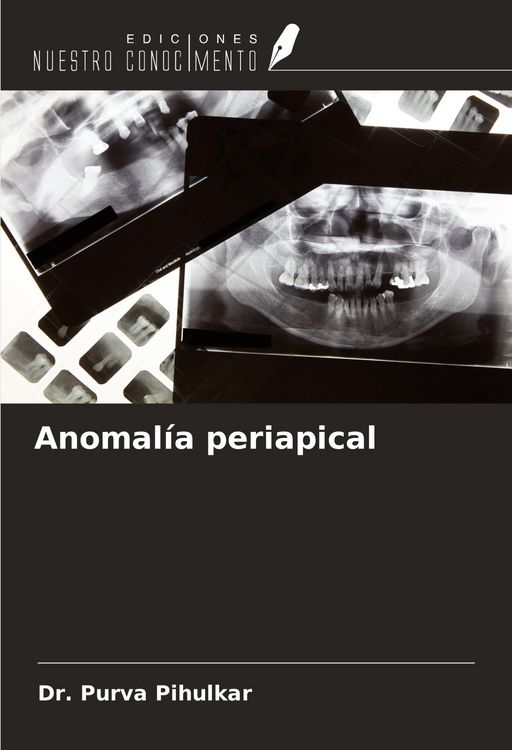 Produktbild: Anomal&iacute;a periapical