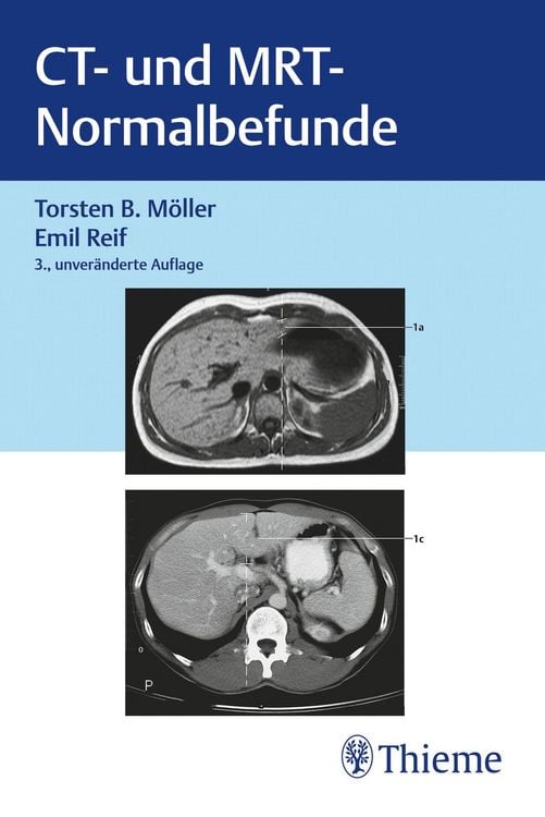 Produktbild: CT und MRT Normalbefunde