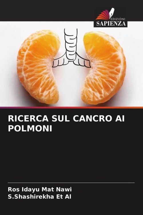Produktbild: Ricerca Sul Cancro Ai Polmoni