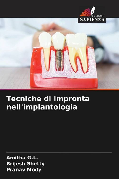 Produktbild: Tecniche di impronta nell'implantologia