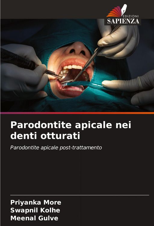 Produktbild: Parodontite apicale nei denti otturati