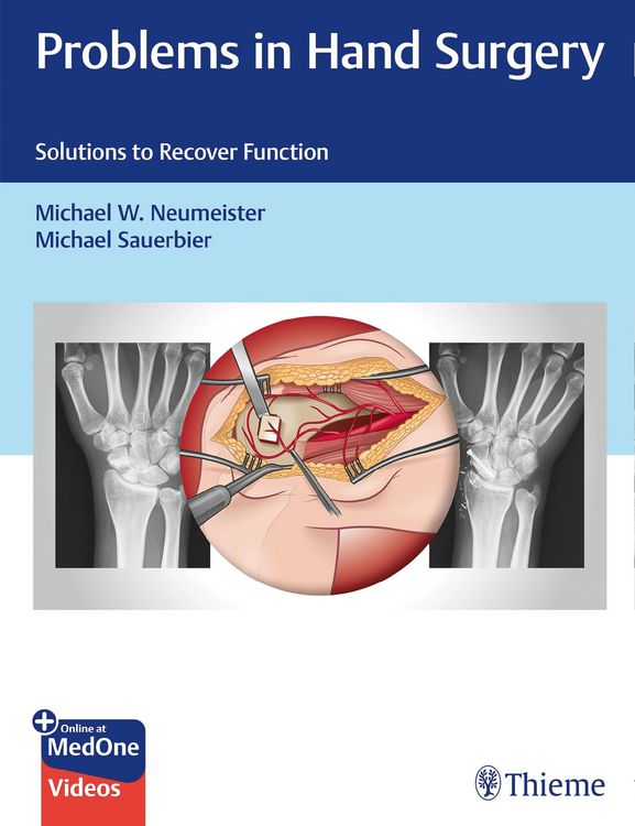 Produktbild: Problems in Hand Surgery