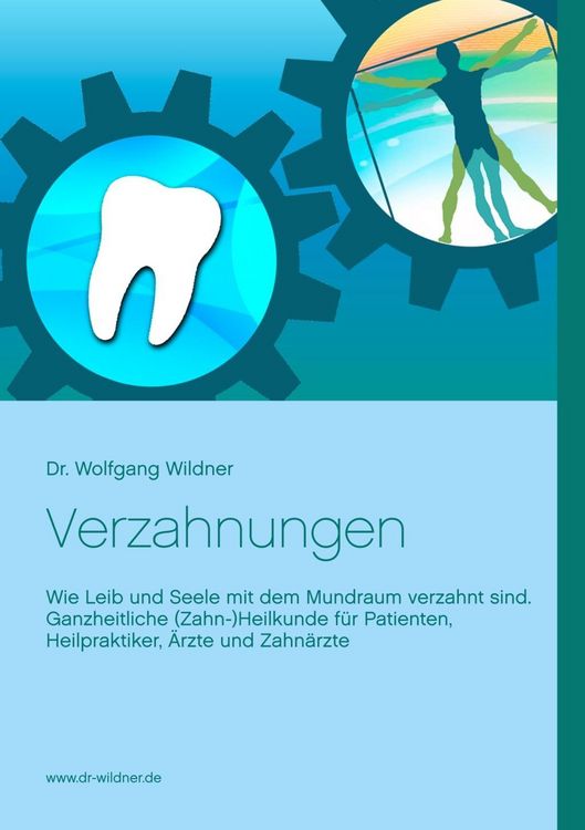 Produktbild: Verzahnungen