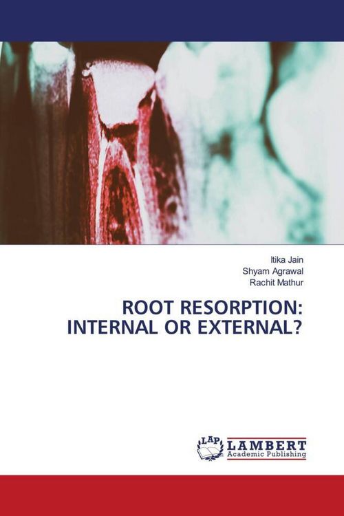Produktbild: Root Resorption: Internal Or External?