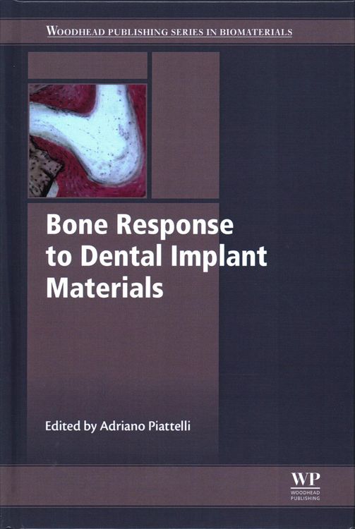 Produktbild: Piattelli, A: Bone Response to Dental Implant Materials