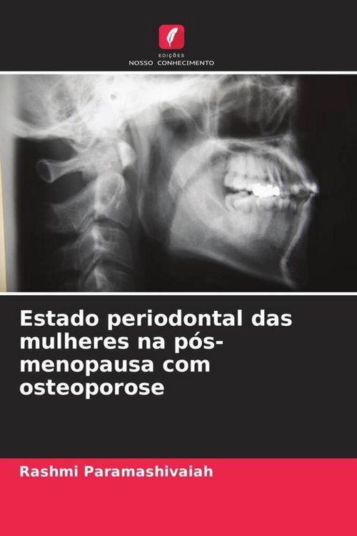 Produktbild: Estado periodontal das mulheres na p&oacute;s-menopausa com osteoporose