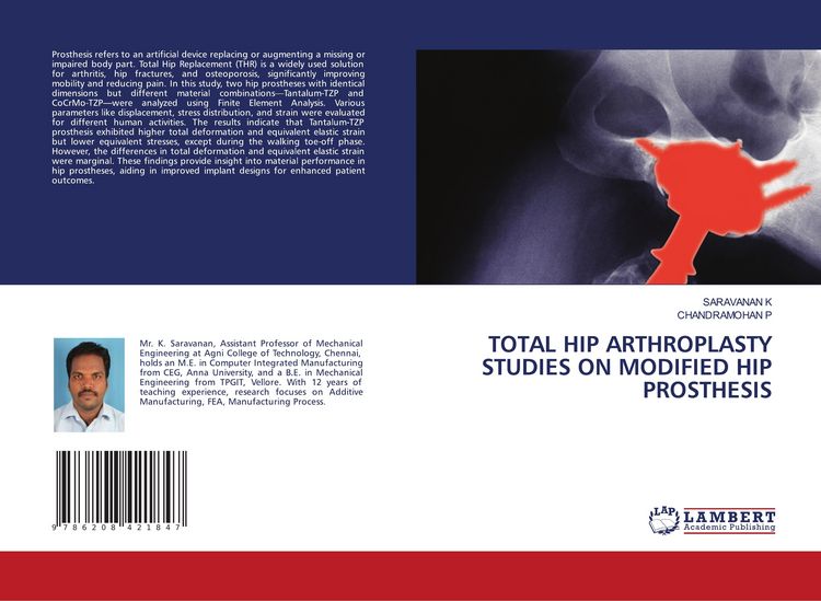 Produktbild: Total Hip Arthroplasty Studies On Modified Hip Prosthesis