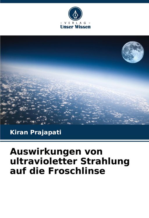Produktbild: Auswirkungen von ultravioletter Strahlung auf die Froschlinse
