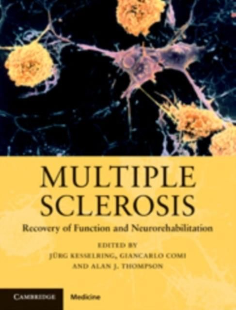 Produktbild: Multiple Sclerosis