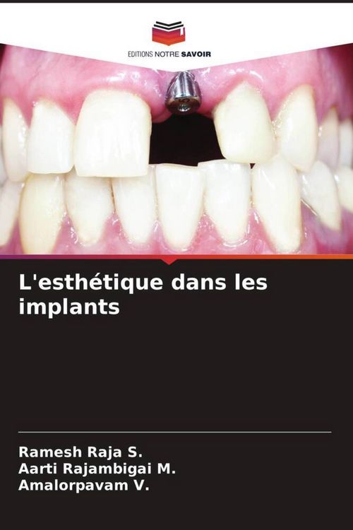 Produktbild: L'esth&eacute;tique dans les implants
