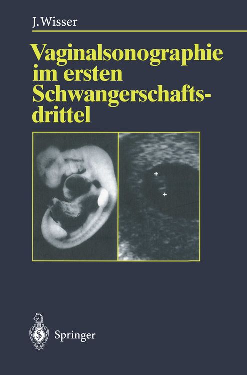 Produktbild: Vaginalsonographie im ersten Schwangerschaftsdrittel