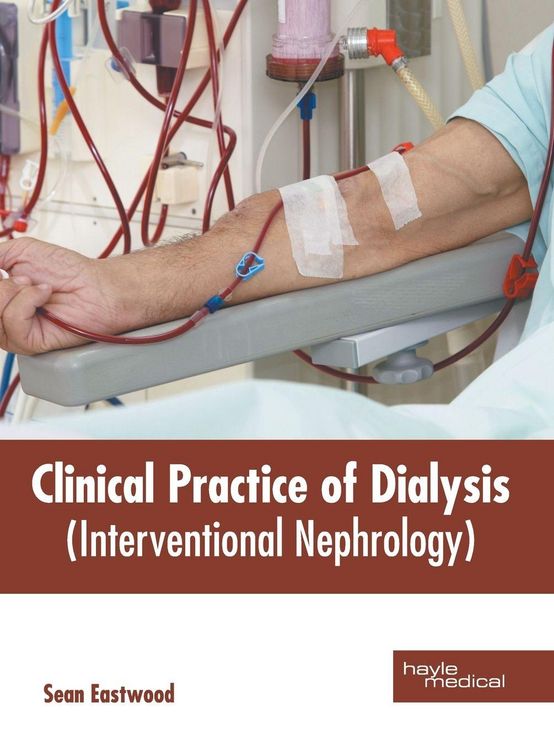 Produktbild: Clinical Practice of Dialysis (Interventional Nephrology)