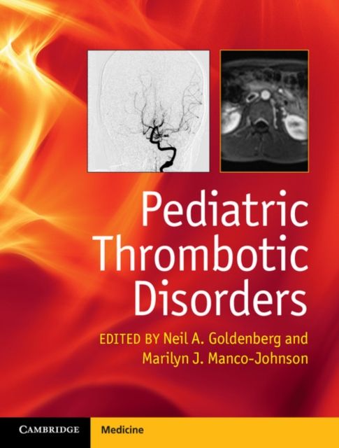 Produktbild: Pediatric Thrombotic Disorders
