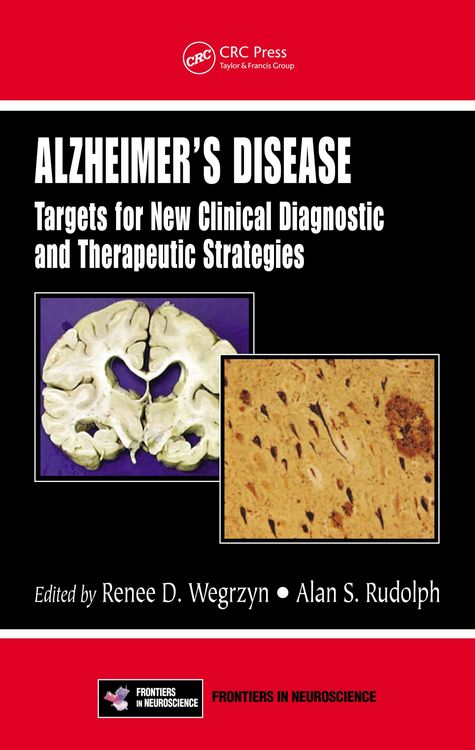 Produktbild: Alzheimer's Disease