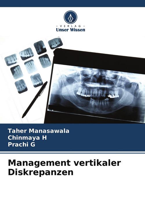Produktbild: Management vertikaler Diskrepanzen