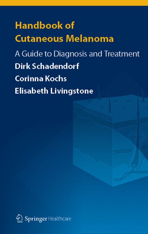 Produktbild: Handbook of Cutaneous Melanoma