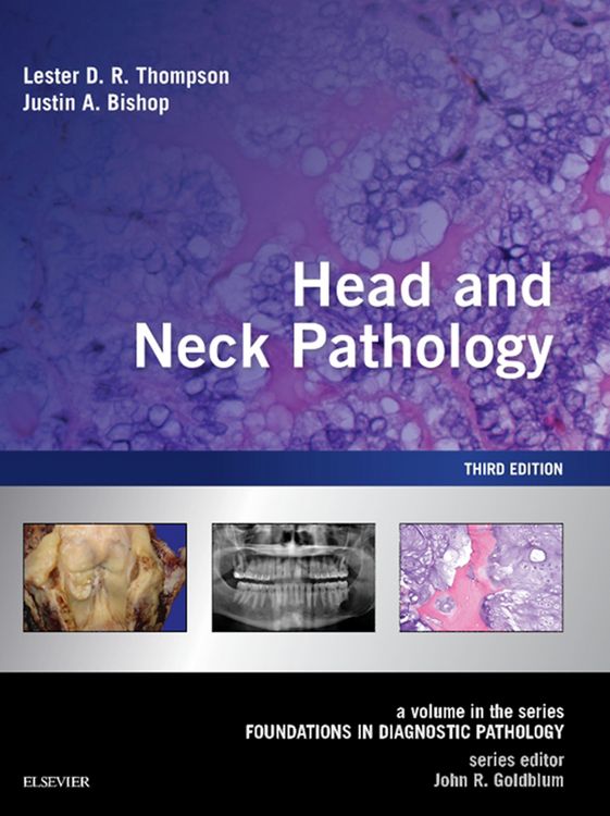 Produktbild: Head and Neck Pathology E-Book