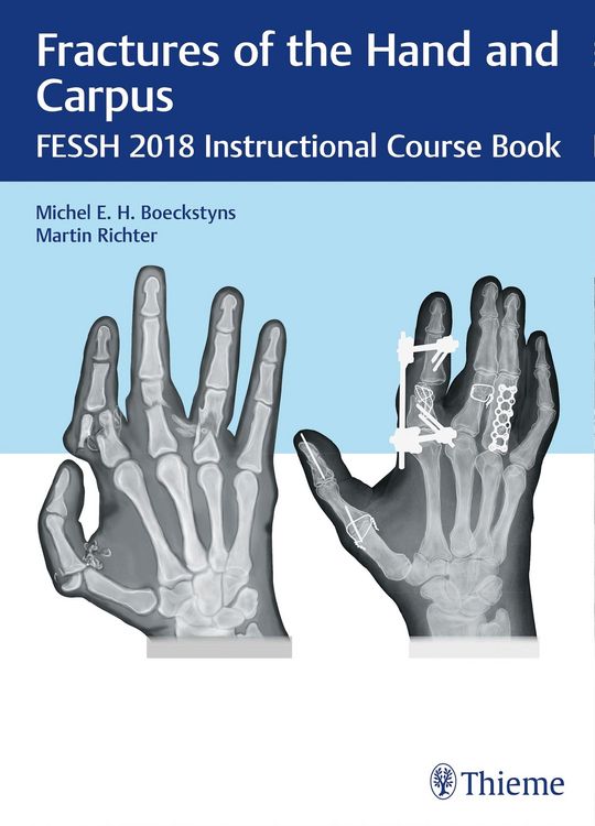 Produktbild: Fractures of the Hand and Carpus
