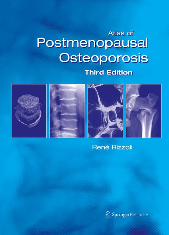 Produktbild: Atlas of Postmenopausal Osteoporosis