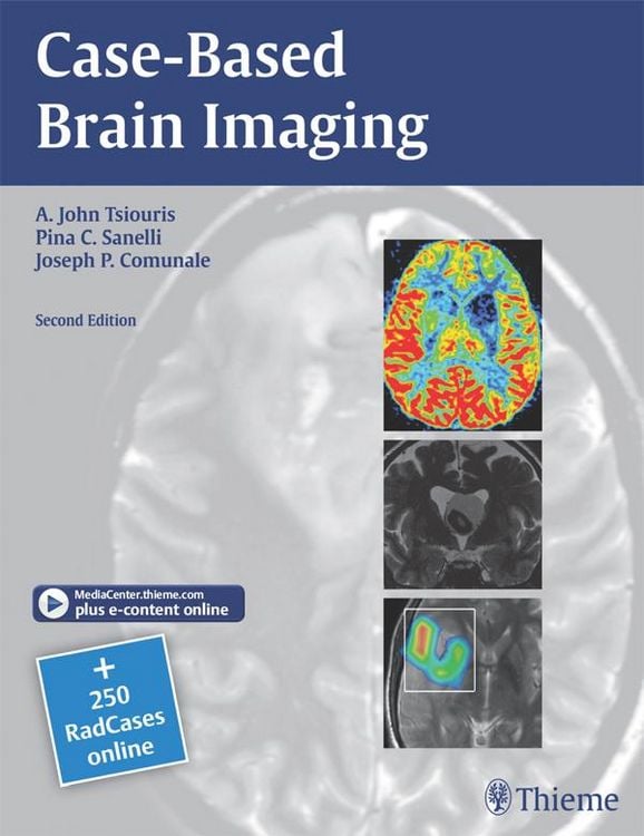 Produktbild: Case-Based Brain Imaging