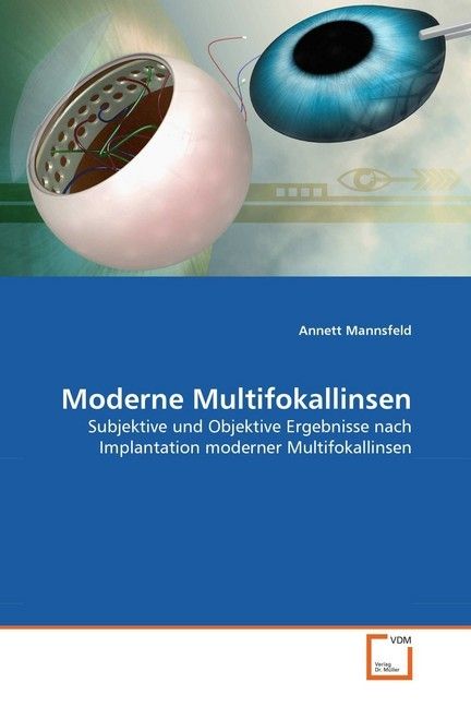 Produktbild: Mannsfeld, A: Moderne Multifokallinsen