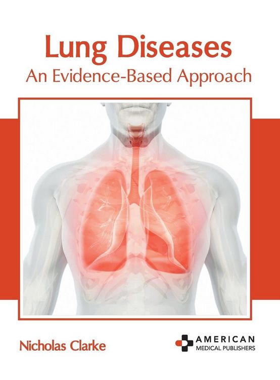 Produktbild: Lung Diseases: An Evidence-Based Approach