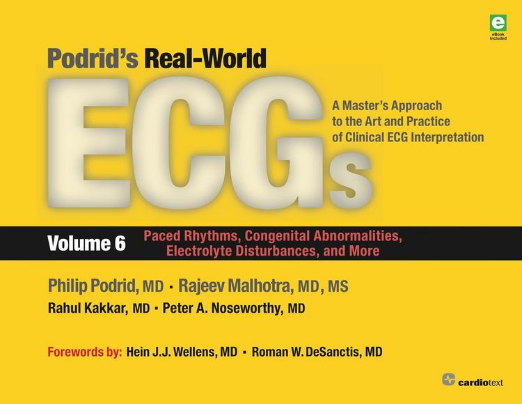 Produktbild: Podrid's Real-World ECGs: Volume 6, Paced Rhythms, Congenital Abnormalities, Electrolyte Disturbances, and More