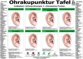 Produktbild: Ohrakupunktur Tafel - Indikation: Schmerztherapie 2