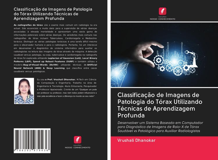 Produktbild: Classifica&ccedil;&atilde;o de Imagens de Patologia do T&oacute;rax Utilizando T&eacute;cnicas de Aprendizagem Profunda