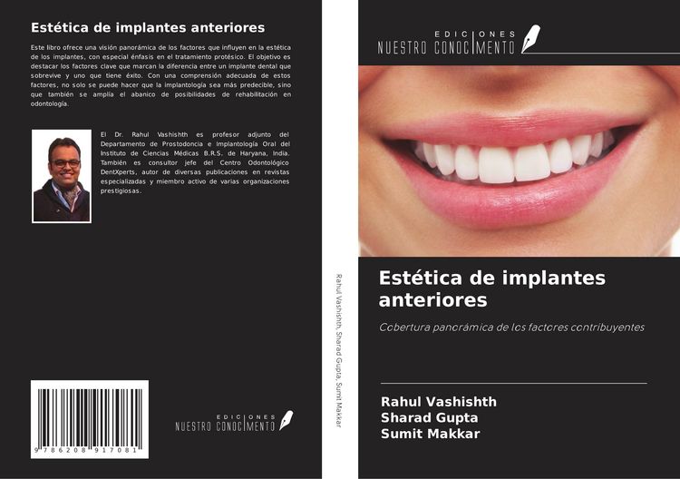Produktbild: Est&eacute;tica de implantes anteriores